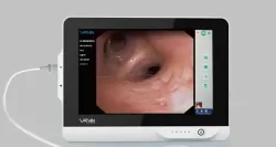 Hordozható Monitor bronchoszkóphoz 12.8''