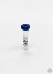 Nátrium-citrátos antikoaguláns cső