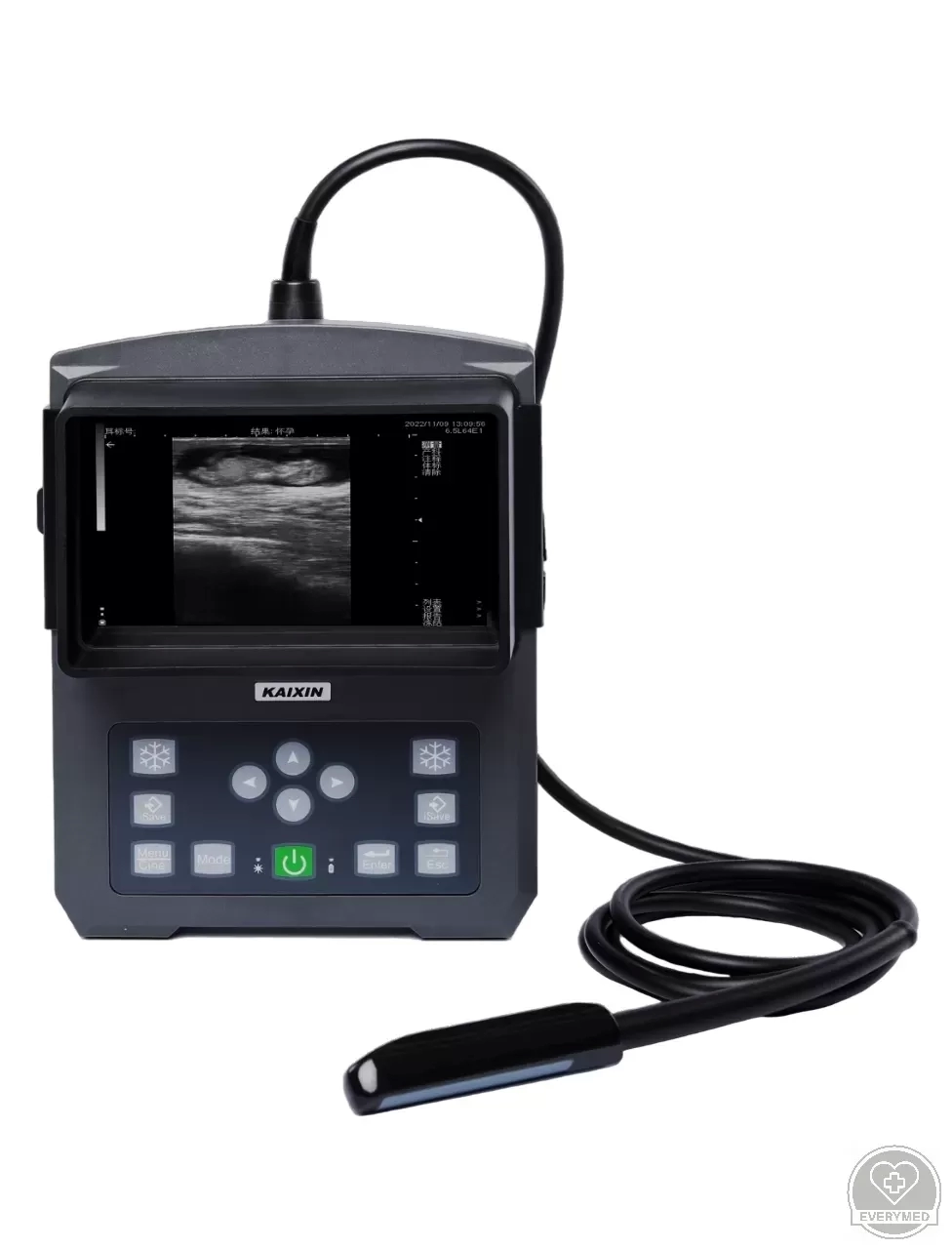 Hordozható digitális ultrahang diagnosztikai készülék