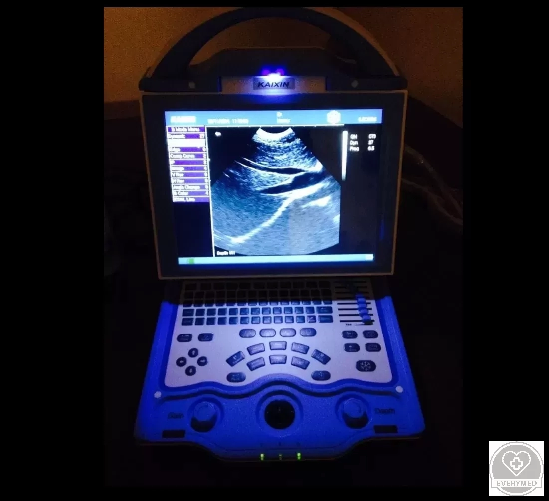 Digitális B-mód ultrahangos készülék