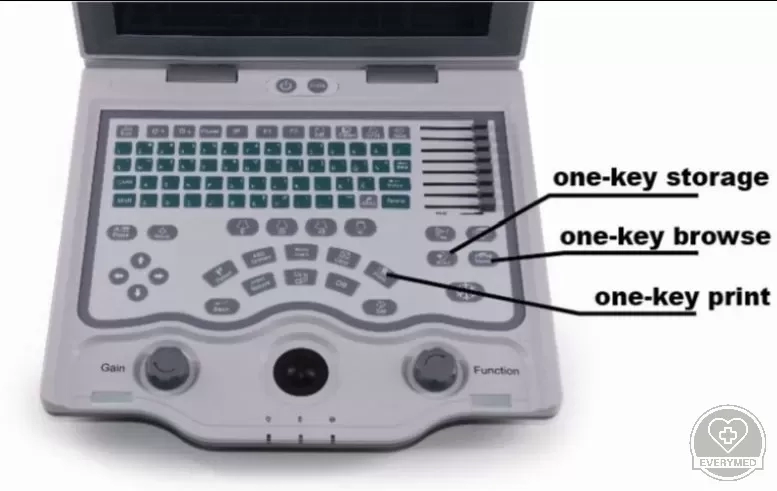 Digitális B-mód ultrahangos készülék